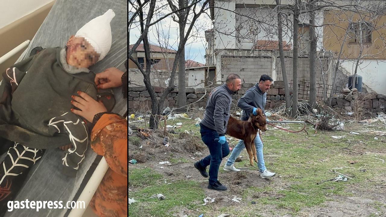 Kayseri’de Başıboş Köpek Saldırısı: 3 Yaşındaki Çocuk Ağır Yaralandı!
