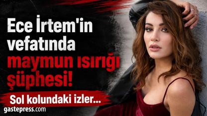 Ece İrtem'in vefatında maymun ısırığı şüphesi! Sol kolundaki izler...